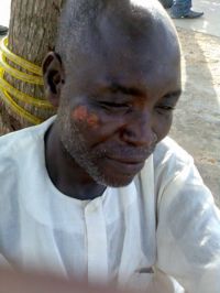 Muslim leper on Calabar street